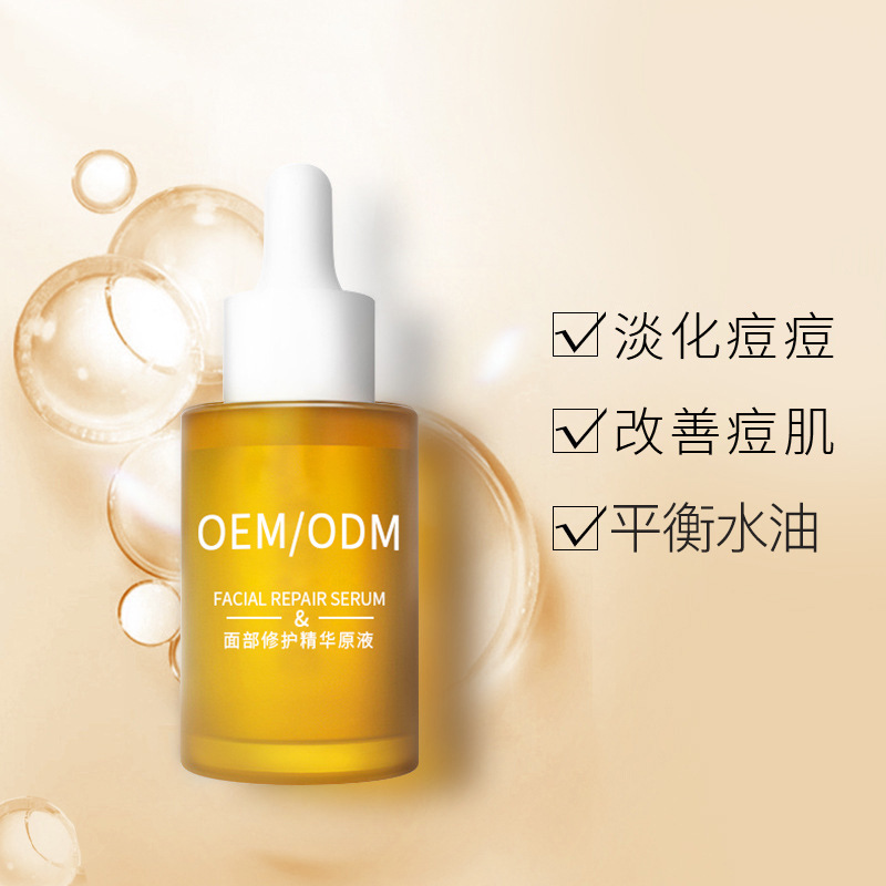 天水市_祛痘精华原液OEM
